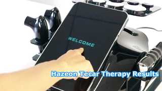 RL-W20 Hazeon Tecar セラピー マシン – 高度な 448kHz 理学療法およびリハビリテーション デバイス